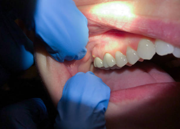 Best Emergency Cosmetic Dentistry in East Dundee, IL